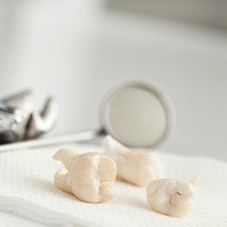 Several extracted teeth on gauze next to dental instruments