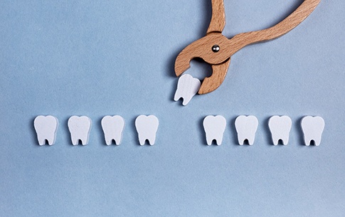 Illustration of a tooth extraction with wooden blocks