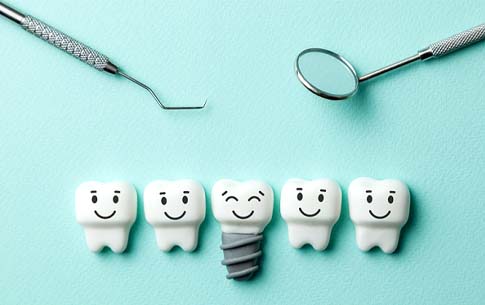 Illustration of dental implants in Conway