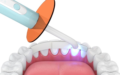 Animation of spliting treatment