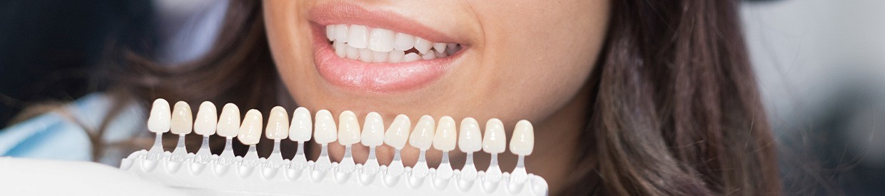 Closeup of smile compared with tooth color chart