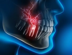 3D drawing of dental pain