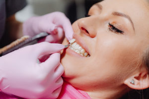 Woman at consultation for veneers