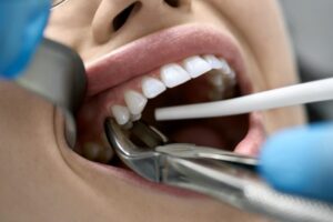 Patient having tooth extracted.