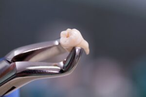 Dental tool holding extracted tooth. 